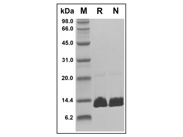 aladdin 阿拉丁 rp149785 Recombinant Human Parathyroid Hormone Protein Animal Free, >97% (SDS-PAGE&HPLC), Active, E. coli, No tag, 32-115 aa