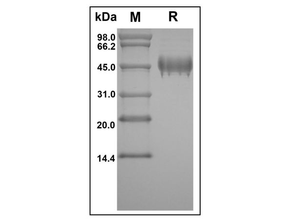 aladdin 阿拉丁 rp150051 Recombinant Human Serpin F1/PEDF Protein Animal Free, ＞97%(SDS-PAGE, HPLC), Active, E.coli, No tag, 20-418 aa