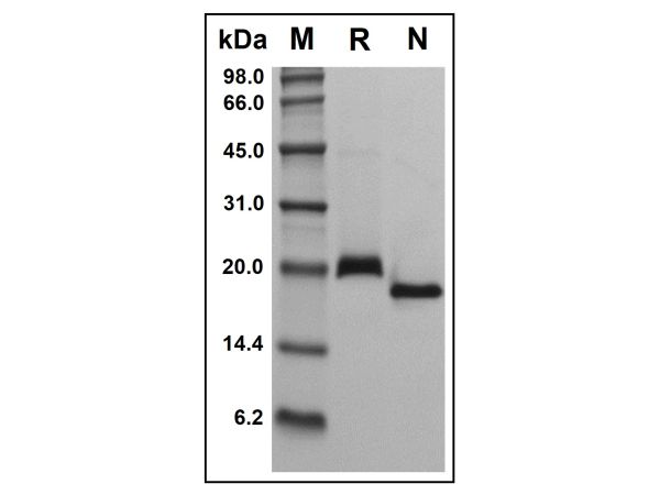 aladdin 阿拉丁 rp150851 Recombinant Human RANK Protein Animal Free, >98%(SDS-PAGE), Active, E. coli, No tag, 29-202 aa