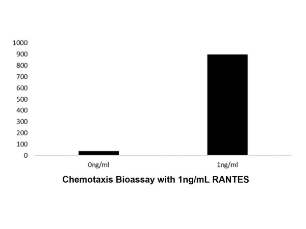 aladdin 阿拉丁 rp150860 Recombinant Human RANTES Protein Animal Free, >98%(SDS-PAGE, HPLC), Active, E.coli, No tag, 24-91 aa