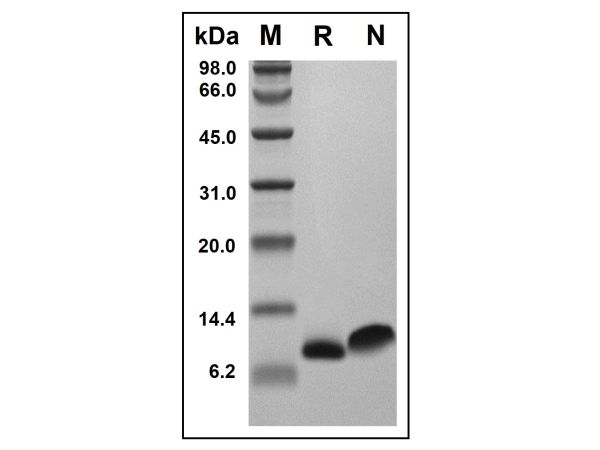 aladdin 阿拉丁 rp150860 Recombinant Human RANTES Protein Animal Free, >98%(SDS-PAGE, HPLC), Active, E.coli, No tag, 24-91 aa