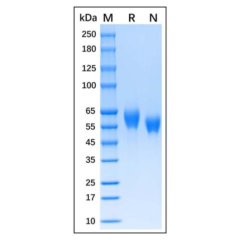 aladdin 阿拉丁 rp151482 Recombinant Human SFRP4 Protein Animal Free, >95%(SDS-PAGE), Active, CHO Stable Cells, C-His tag, 22-346 aa