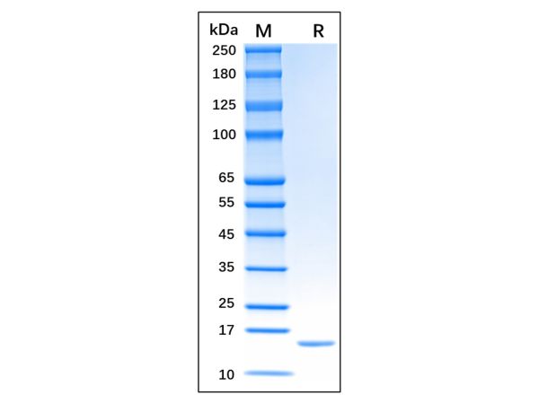 aladdin 阿拉丁 rp152506 Recombinant Human TNF-alpha Protein GMP,  ≥95% (SDS-PAGE), Active, E.coli, No tag, 77-233 aa