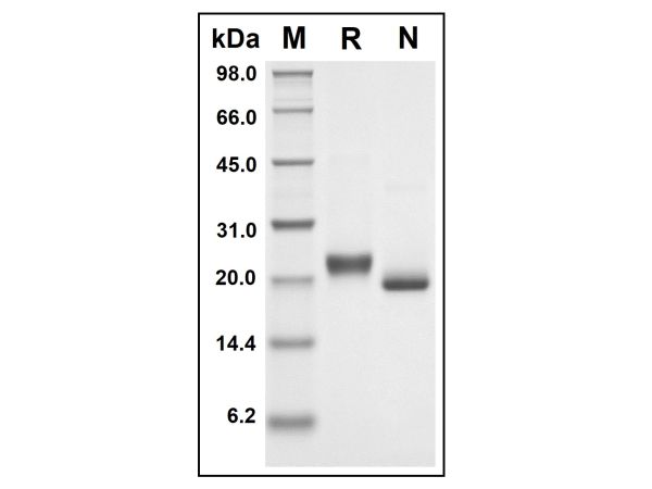 aladdin 阿拉丁 rp152513 Recombinant Human TNFRSF1A Protein Animal Free, >97%(SDS-PAGE, HPLC), Active, E.coli, No tag, 22-211 aa