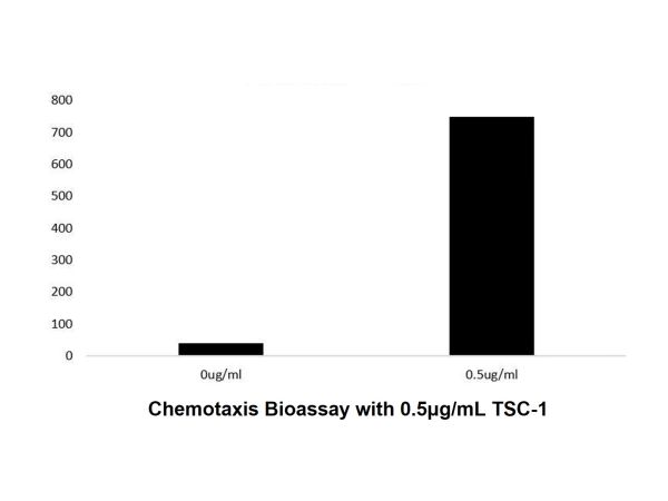 aladdin 阿拉丁 rp152763 Recombinant Human TSC-1 Protein Animal Free, >97%(SDS-PAGE and HPLC), Active, E.coli, No tag, 24-94 aa