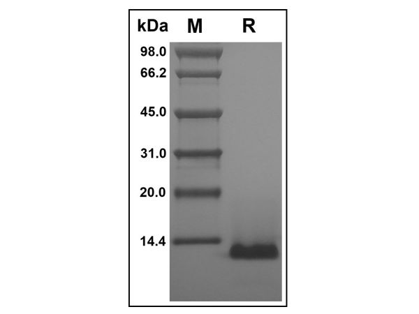 aladdin 阿拉丁 rp152763 Recombinant Human TSC-1 Protein Animal Free, >97%(SDS-PAGE and HPLC), Active, E.coli, No tag, 24-94 aa