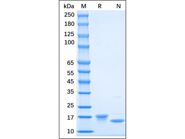 aladdin 阿拉丁 rp155217 Recombinant Rat SCF Protein Animal Free, >95% (SDS-PAGE), Active, E.coli, His-tag, 26-189 aa
