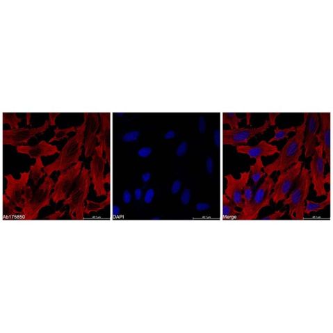 aladdin 阿拉丁 Ab175850 beta Actin Mouse mAb (Biotin) mAb ( FG01/2D10); Mouse anti Human beta actin Antibody; WB, IF, Flow; Biotin