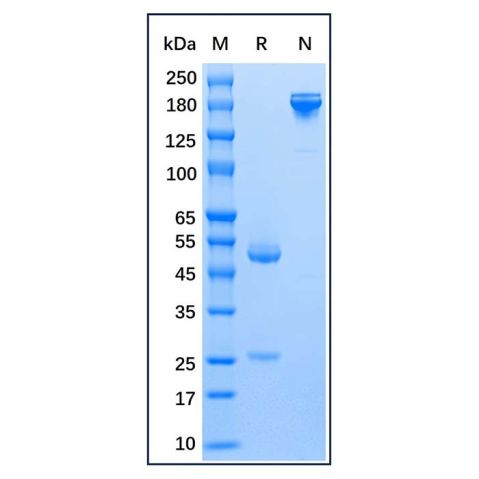 aladdin 阿拉丁 Ab176135 Mouse Anti-Human IgE epsilon chain Antibody Secondary Antibody; Mouse Anti-Human IgE epsilon chain Antibody; WB, CLIA, LF, GICA, EIA; Unconjugated