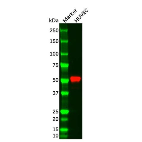 aladdin 阿拉丁 Ab179444 Vimentin Mouse mAb mAb (AB07/4H7); Mouse anti Vimentin Antibody; WB, Flow, ICC/IF, ELISA; Unconjugated