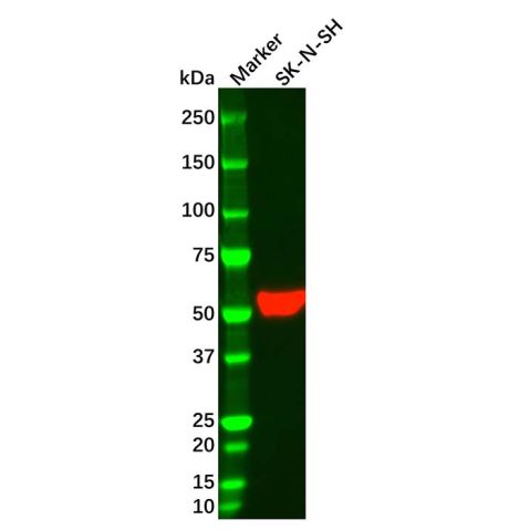 aladdin 阿拉丁 Ab179444 Vimentin Mouse mAb mAb (AB07/4H7); Mouse anti Vimentin Antibody; WB, Flow, ICC/IF, ELISA; Unconjugated