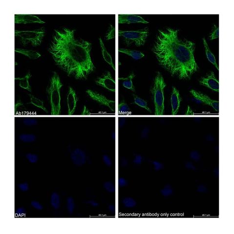 aladdin 阿拉丁 Ab179444 Vimentin Mouse mAb mAb (AB07/4H7); Mouse anti Vimentin Antibody; WB, Flow, ICC/IF, ELISA; Unconjugated