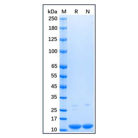 aladdin 阿拉丁 rp156672 Recombinant Human Parvalbumin Protein Carrier Free, >90%(SDS-PAGE), E.coli, C-His tag, 1-110 aa
