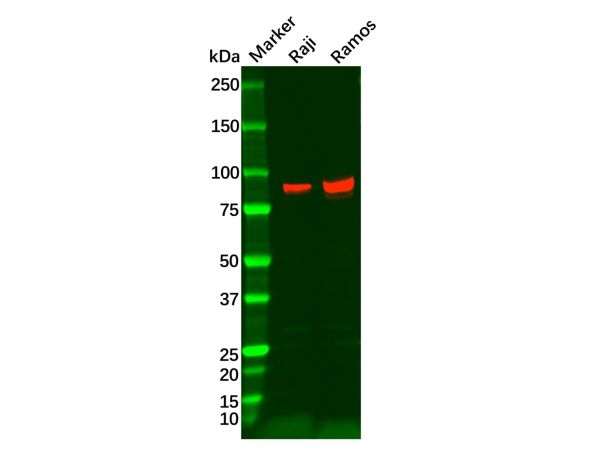 aladdin 阿拉丁 Ab090809 Recombinant BCL6 Antibody Recombinant (R04-9I3); Rabbit anti Human BCL6 Antibody; WB, IHC, IF, ICC; Unconjugated