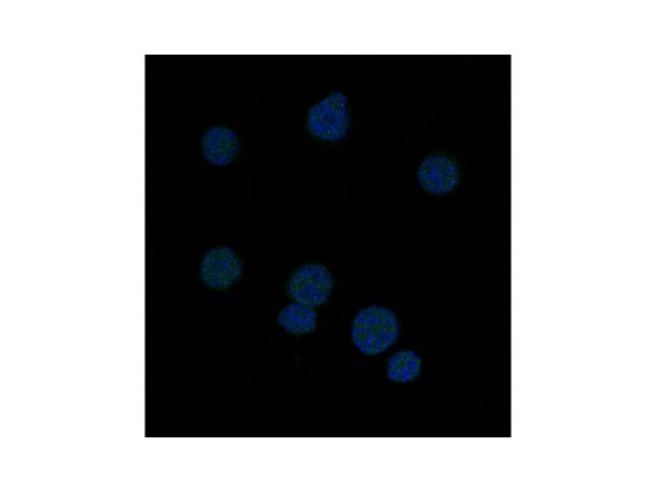 aladdin 阿拉丁 Ab090809 Recombinant BCL6 Antibody Recombinant (R04-9I3); Rabbit anti Human BCL6 Antibody; WB, IHC, IF, ICC; Unconjugated