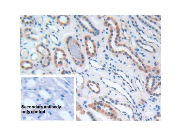 aladdin 阿拉丁 Ab094381 CD276 Antibody pAb; Rabbit anti Human CD276 Antibody; WB, IHC, Flow; Unconjugated