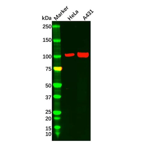 aladdin 阿拉丁 Ab098106 CTNNA1 Antibody pAb; Rabbit anti Human CTNNA1 Antibody; WB, IHC, ICC, IF; Unconjugated