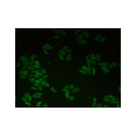 aladdin 阿拉丁 Ab098106 CTNNA1 Antibody pAb; Rabbit anti Human CTNNA1 Antibody; WB, IHC, ICC, IF; Unconjugated