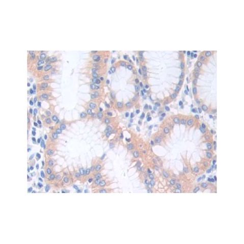 aladdin 阿拉丁 Ab098106 CTNNA1 Antibody pAb; Rabbit anti Human CTNNA1 Antibody; WB, IHC, ICC, IF; Unconjugated