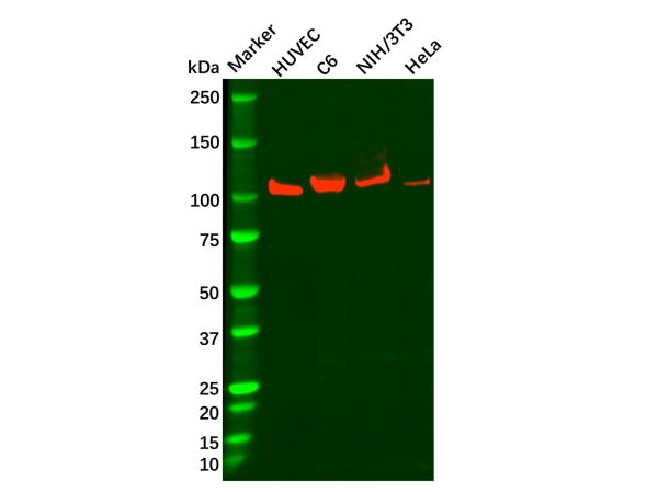 aladdin 阿拉丁 Ab100490 Recombinant Drebrin Antibody Recombinant (R06-1A2); Rabbit anti Human Drebrin Antibody; WB; Unconjugated