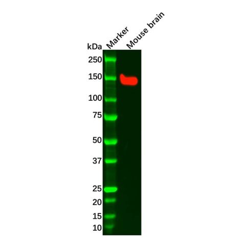 aladdin 阿拉丁 Ab103359 Recombinant FGFR2 Antibody Recombinant (R01-3I4); Rabbit anti Human FGFR2 Antibody; WB; Unconjugated