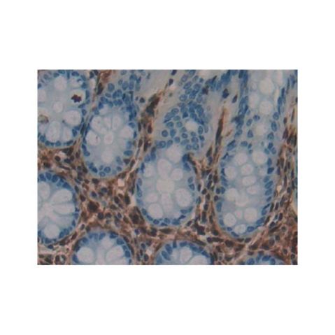 aladdin 阿拉丁 Ab104554 Galectin 1 Antibody pAb; Rabbit anti Human Galectin 1 Antibody; WB, IHC; Unconjugated