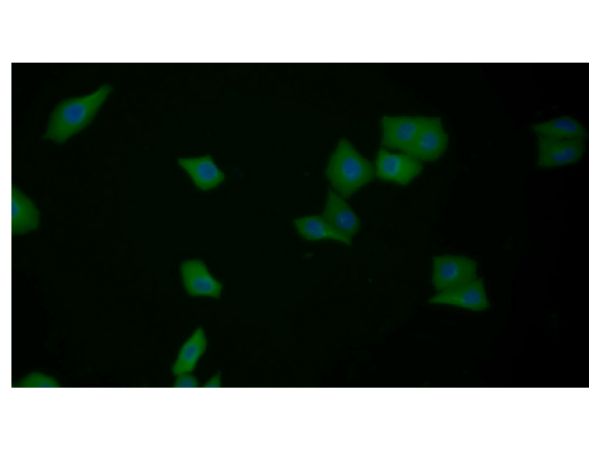 aladdin 阿拉丁 Ab104584 Galectin 3 Antibody pAb; Rabbit anti Human Galectin 3 Antibody; WB, IHC, ICC, IF; Unconjugated