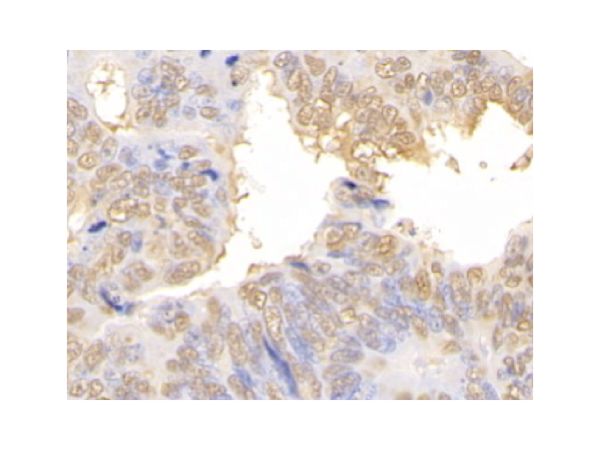 aladdin 阿拉丁 Ab104584 Galectin 3 Antibody pAb; Rabbit anti Human Galectin 3 Antibody; WB, IHC, ICC, IF; Unconjugated