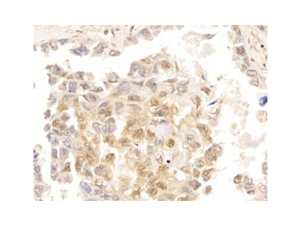 aladdin 阿拉丁 Ab104584 Galectin 3 Antibody pAb; Rabbit anti Human Galectin 3 Antibody; WB, IHC, ICC, IF; Unconjugated