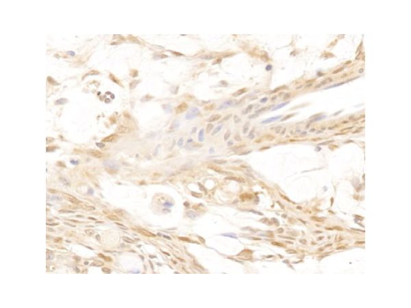 aladdin 阿拉丁 Ab104584 Galectin 3 Antibody pAb; Rabbit anti Human Galectin 3 Antibody; WB, IHC, ICC, IF; Unconjugated