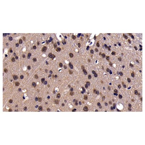 aladdin 阿拉丁 Ab106543 GRP94 Antibody pAb; Rabbit anti Human GRP94 Antibody; WB, IHC; Unconjugated