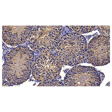 aladdin 阿拉丁 Ab106543 GRP94 Antibody pAb; Rabbit anti Human GRP94 Antibody; WB, IHC; Unconjugated