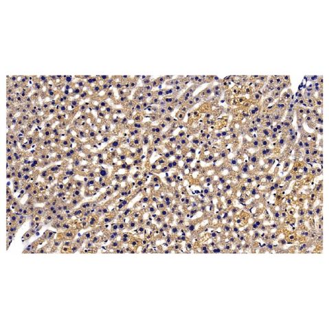 aladdin 阿拉丁 Ab106543 GRP94 Antibody pAb; Rabbit anti Human GRP94 Antibody; WB, IHC; Unconjugated