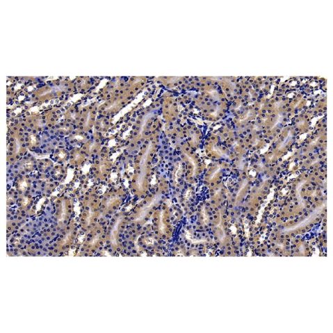 aladdin 阿拉丁 Ab106543 GRP94 Antibody pAb; Rabbit anti Human GRP94 Antibody; WB, IHC; Unconjugated