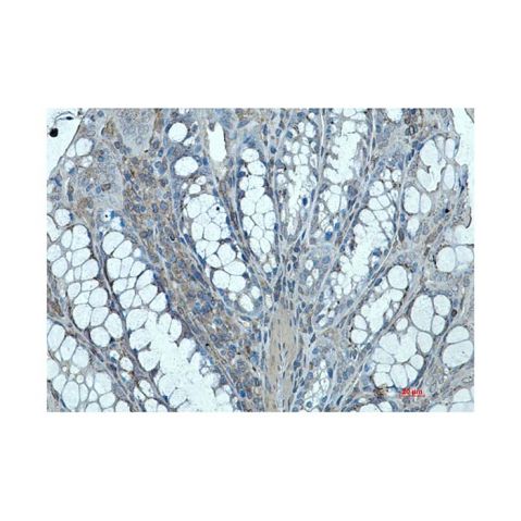 aladdin 阿拉丁 Ab109665 Recombinant Ihh Antibody Recombinant (R03-3F2); Rabbit anti Human Ihh Antibody; WB, IHC; Unconjugated