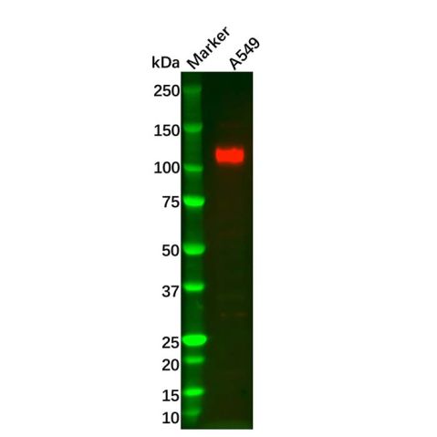 aladdin 阿拉丁 Ab113089 Recombinant LI Cadherin Antibody Recombinant (R04-5A8); Rabbit anti Human LI Cadherin Antibody; WB; Unconjugated