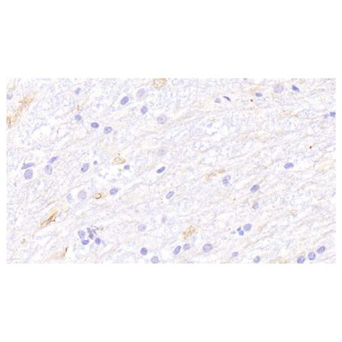 aladdin 阿拉丁 Ab122119 PKC zeta Antibody pAb; Rabbit anti Human PKC zeta Antibody; WB, IHC; Unconjugated