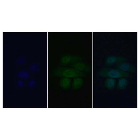 aladdin 阿拉丁 Ab134725 Wnt1 Antibody pAb; Rabbit anti Human Wnt1 Antibody; WB, IHC, IF, ICC; Unconjugated