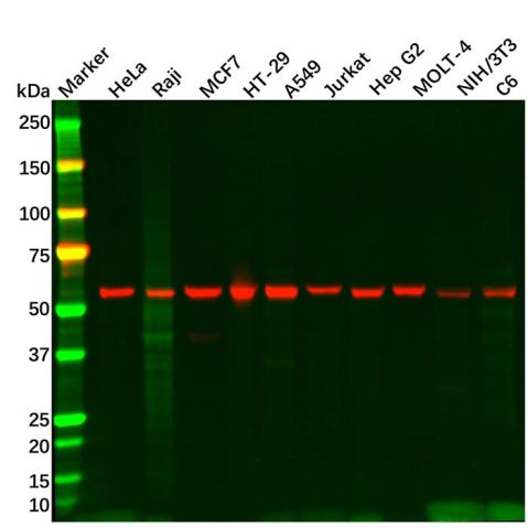 aladdin 阿拉丁 Ab134877 XIAP Antibody pAb; Rabbit anti Human XIAP Antibody; WB, IHC, IF, ICC; Unconjugated