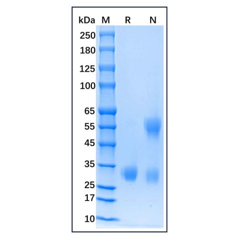 aladdin 阿拉丁 rp142573 Recombinant Human Adiponectin/Acrp30 Protein Animal Free, >95%(SDS-PAGE), Active, 293F, His tag, 19-244 aa