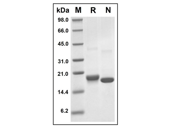 aladdin 阿拉丁 rp142973 Recombinant Human ARMET/ARP Protein Animal Free, >95%(SDS-PAGE and HPLC), Active, E.coli, No tag, 25-182aa