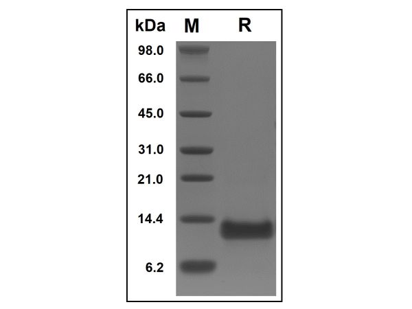 aladdin 阿拉丁 rp143136 Recombinant Human BAFFR/TNFRSF13C Protein Animal Free, >95%(SDS-PAGE), Active, E.coli, No tag, 1-76 aa