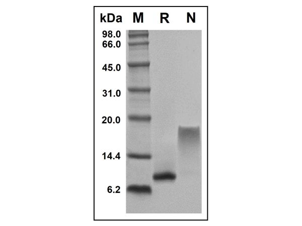 aladdin 阿拉丁 rp143739 Recombinant Human CCL23/MPIF-1 Protein Animal Free, >97%(SDS-PAGE and HPLC), Active, E.coli, No tag,  22-120 aa