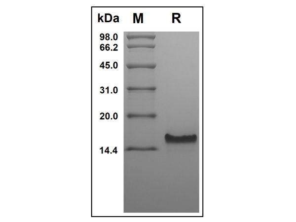 aladdin 阿拉丁 rp143741 Recombinant Human CCL25 Protein Animal Free, >97%(SDS-PAGE and HPLC), Active, E.coli, No tag, 24-150 aa