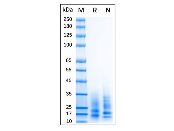 aladdin 阿拉丁 rp144137 Recombinant Human CD83 Protein Animal Free, >90%(SDS-PAGE), Active, 293F, His tag, 20-143 aa