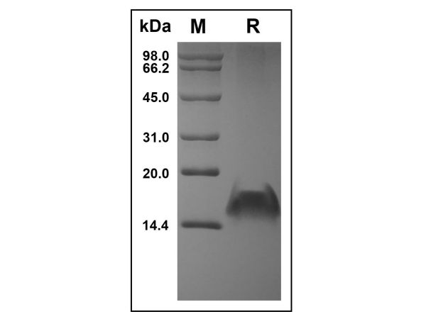 aladdin 阿拉丁 rp144872 Recombinant Human CXCL9 Protein Carrier Free, >97% (SDS-PAGE), Active, E.coli, No tag, 23-125 aa