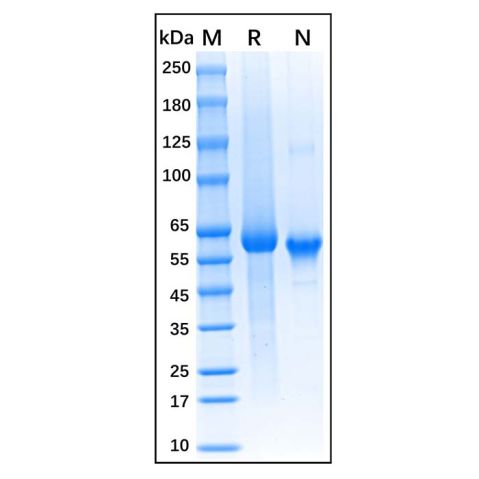 aladdin 阿拉丁 rp145162 Recombinant Human DLL1 Protein Animal Free, >95% (SDS-PAGE), Active, HEK293, C-His tag, 22-540 aa