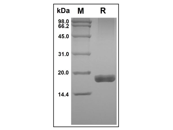 aladdin 阿拉丁 rp145269 Recombinant Human TRAIL R2/TNFRSF10B Protein Animal Free, >97% (SDS-PAGE&HPLC), Active, E.coli, No tag, 52-183 aa