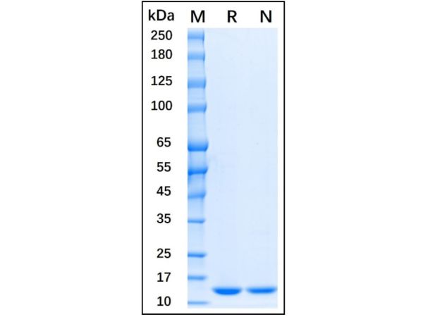 aladdin 阿拉丁 rp145772 Recombinant Human FABP4 Protein Animal Free, > 95%(SDS-PAGE), Active, 293F, His tag, 2-132 aa