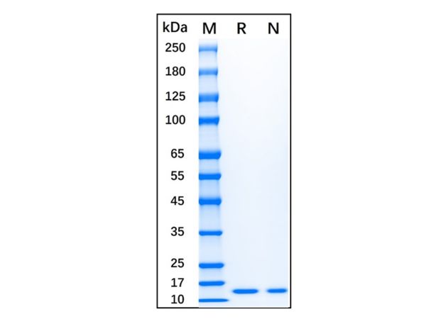aladdin 阿拉丁 rp145907 Recombinant human FGF1 protein Animal Free, >95% SDS-PAGE, Active, E.coli, No tag, 16-155 aa